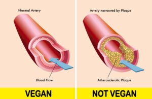 Lower the level of cholesterol in the blood