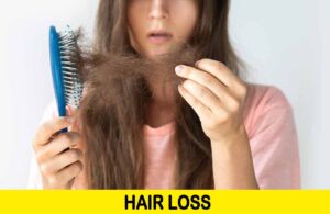 hair loss