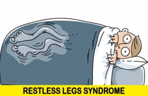 restless legs syndrome